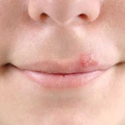 FirstDerm FirstDerm