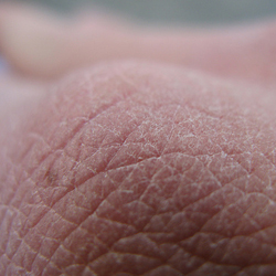 FirstDerm FirstDerm
