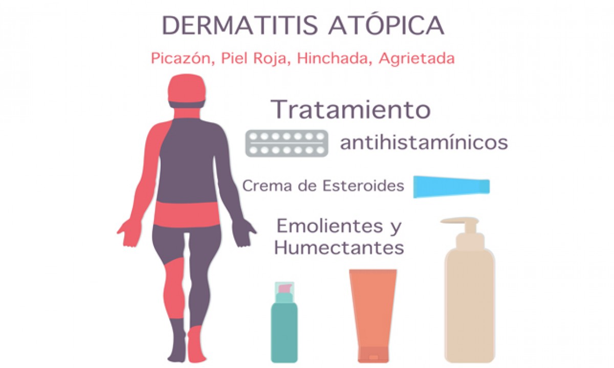Cuidados diarios para la dermatitis atópica